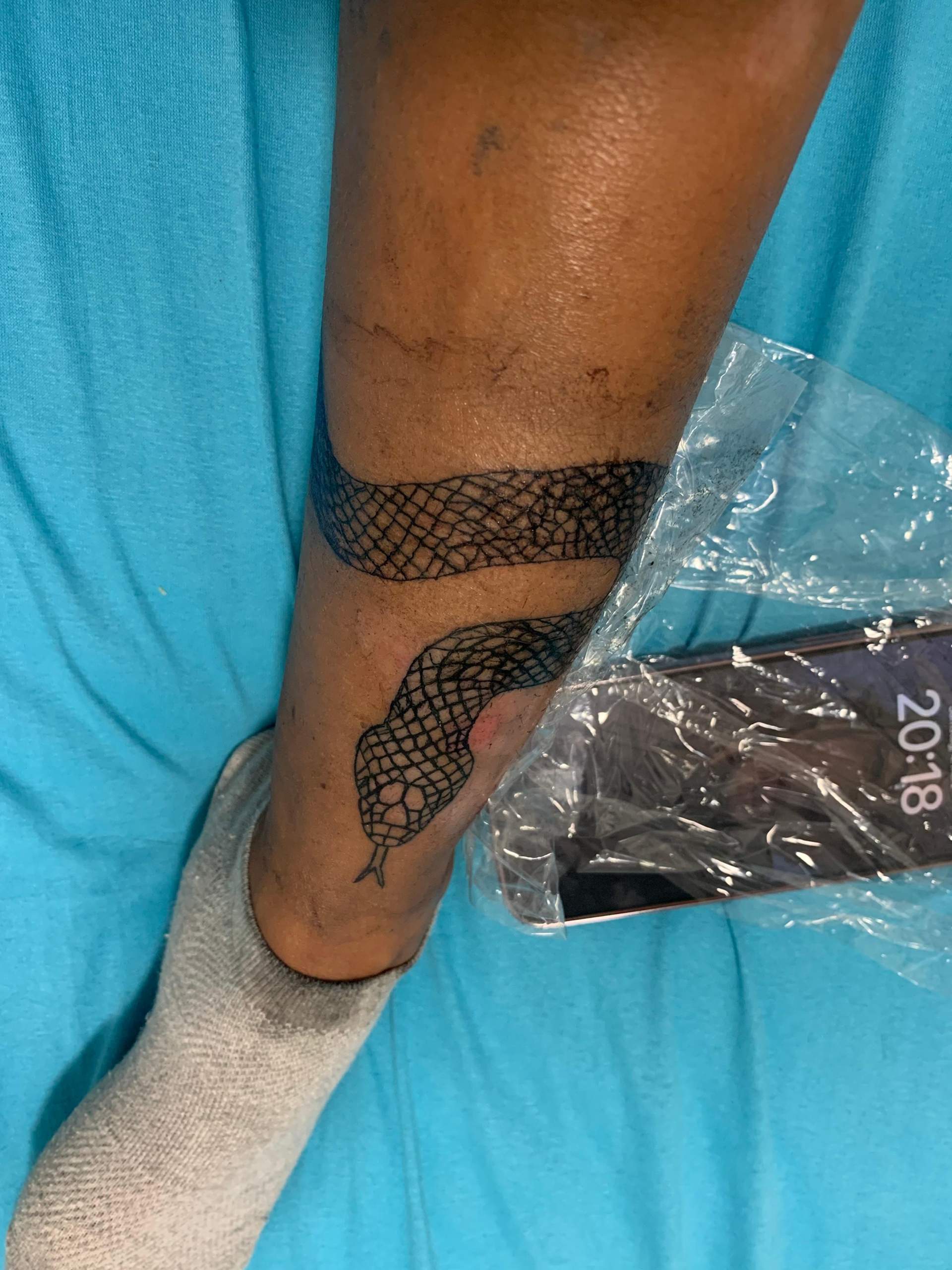 Tatto schlecht gestochen? (Aussehen, Tattoo, tätowieren)