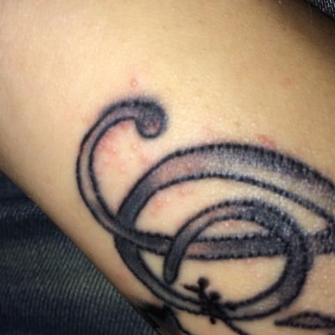Tattoo Hautausschlag Hilfe Angst Tattoo Hautausschlag Hilfe Angst