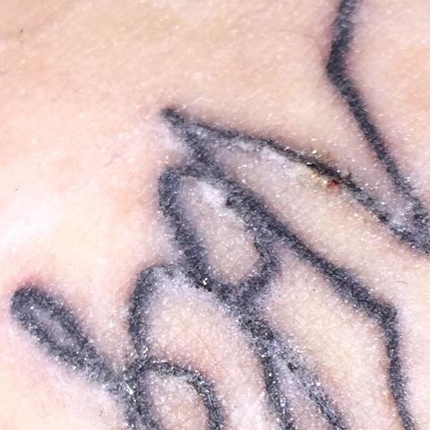 Tattoo Abheilung Blut Kommt Raus Medizin Heilung Tatowieren