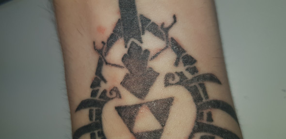 - (Tattoo, Allergie, Entzündung)