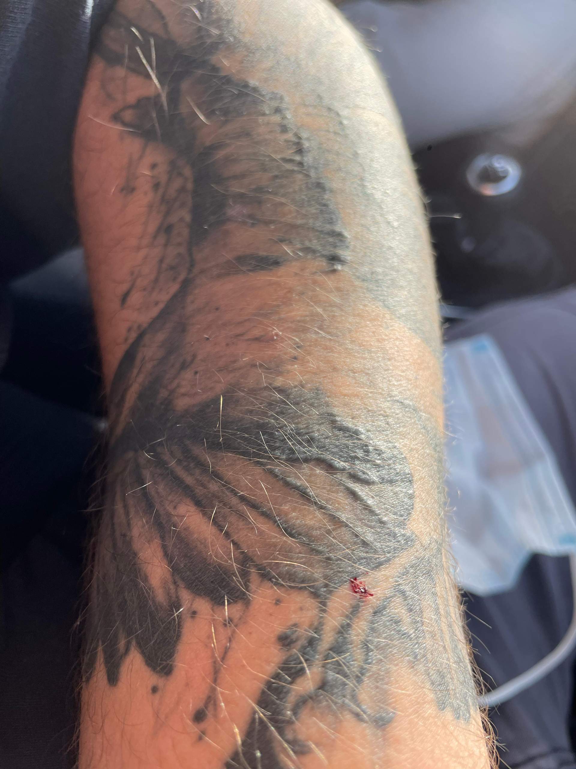 Tattoo auf einmal vernarbt? (tätowieren, Tätowierer)