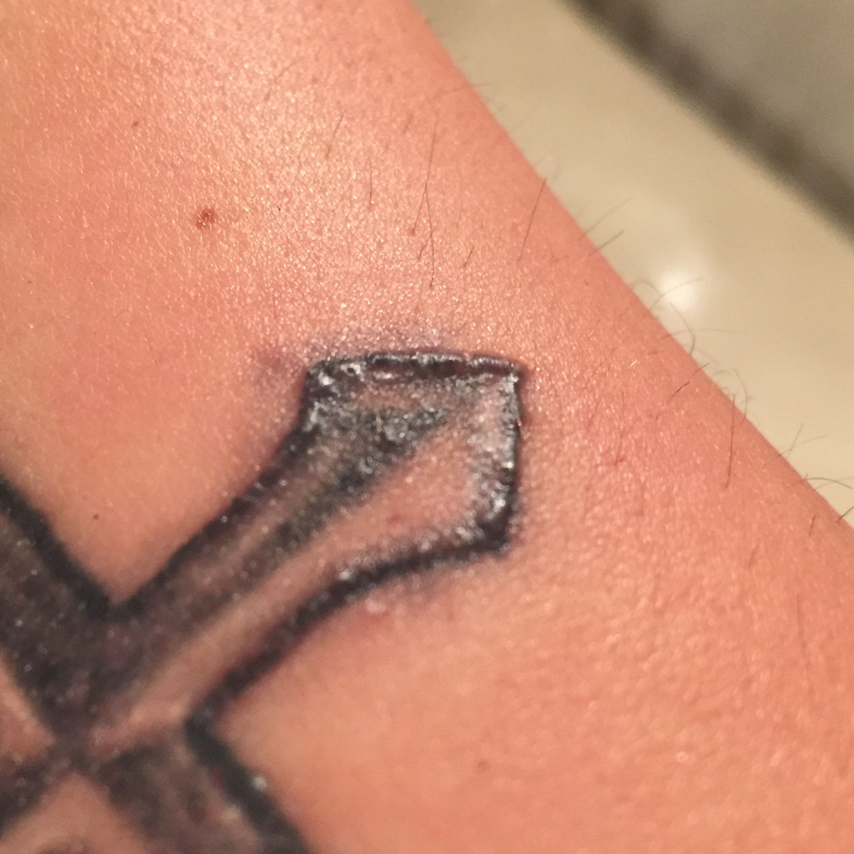 Tattoo ausschlag?