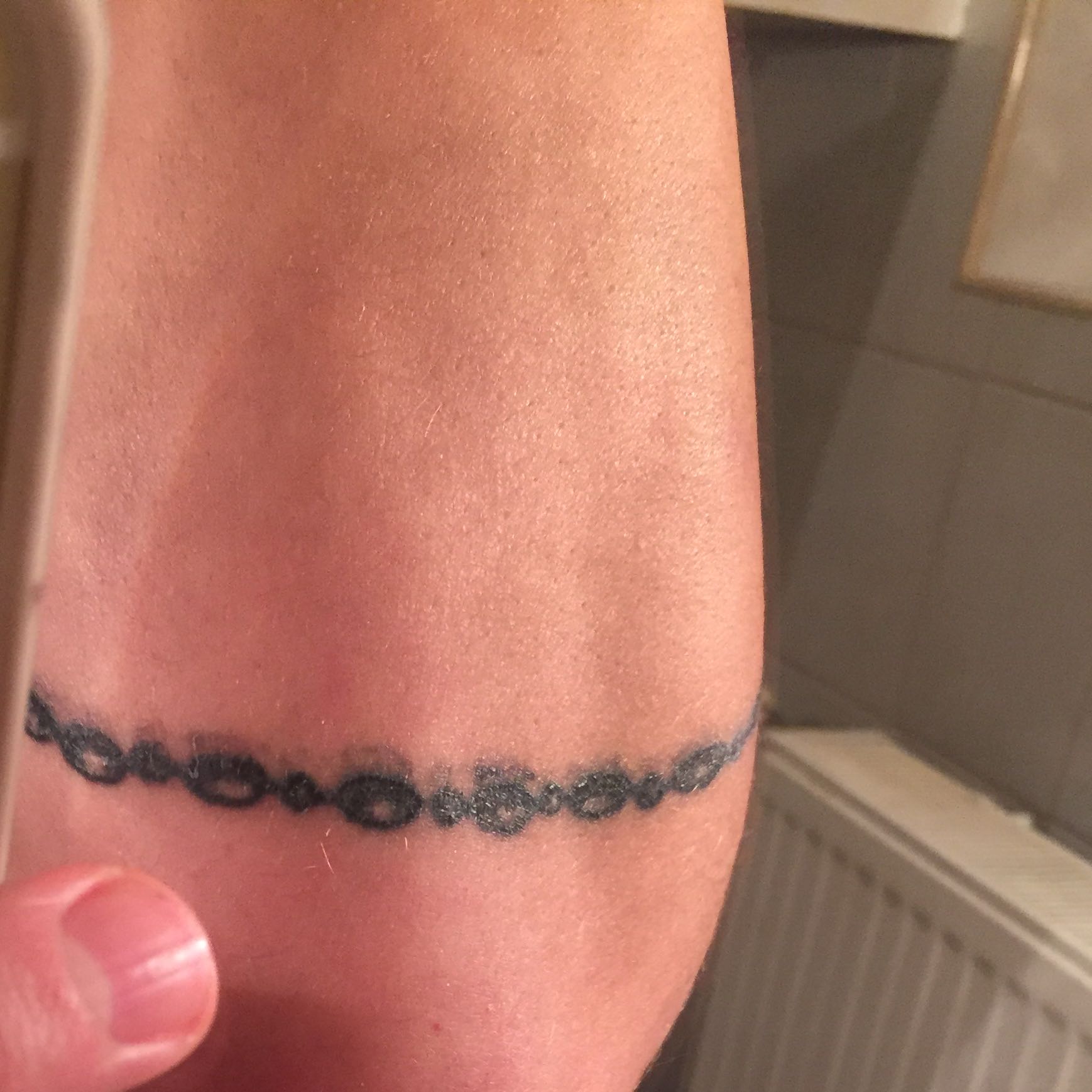 Tattoo ausschlag?