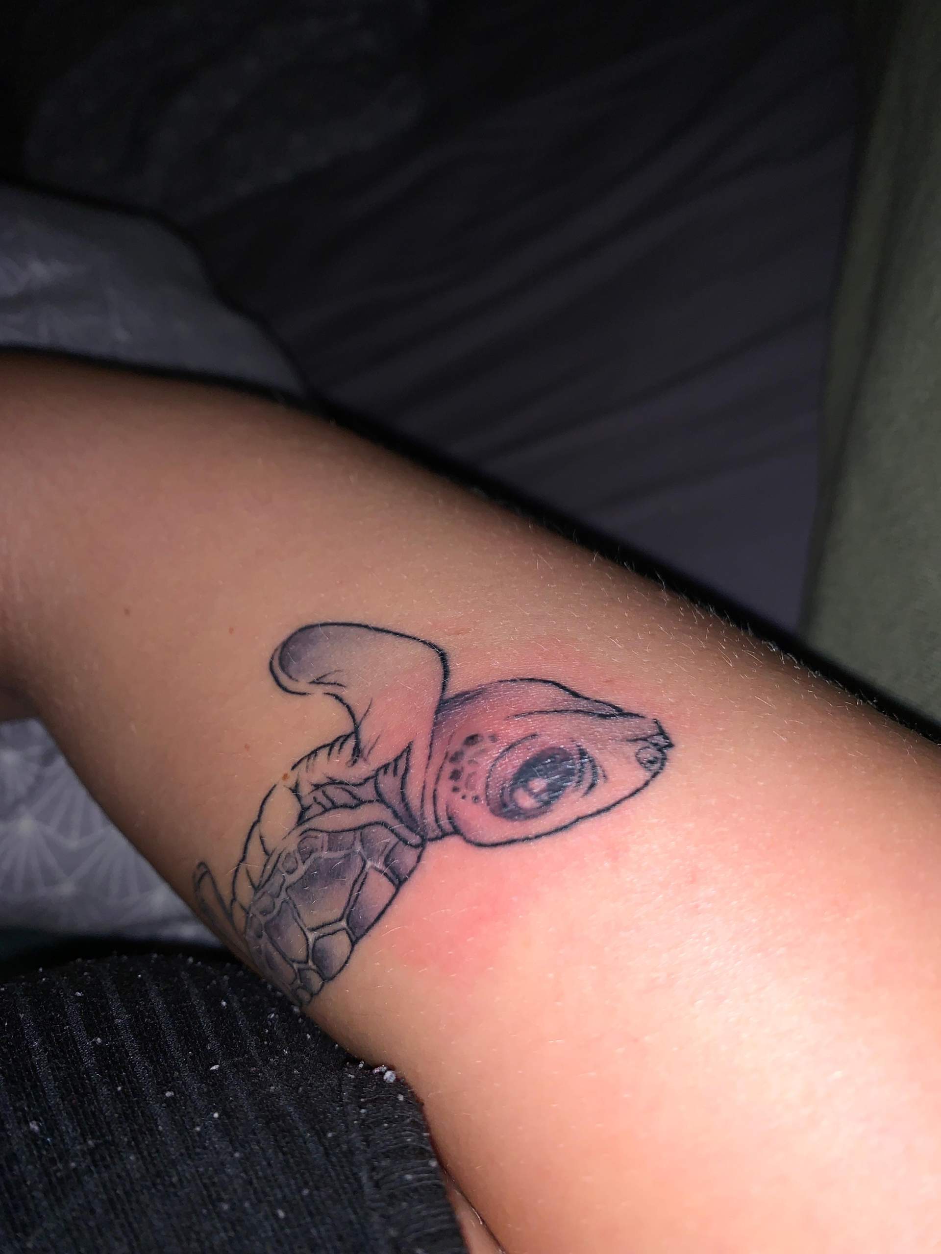 Tattoo beule unter der Haut? (Schmerzen, Entzündung)
