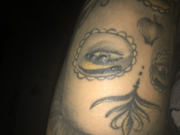 Tattoo Beulen Pickel Beule