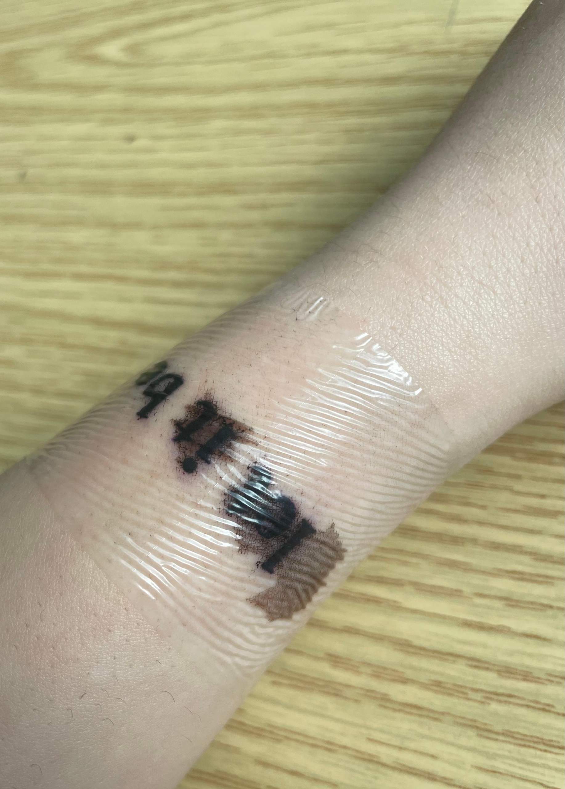 Tattoo blutet stark? (Schmerzen, Blut, Entzündung)