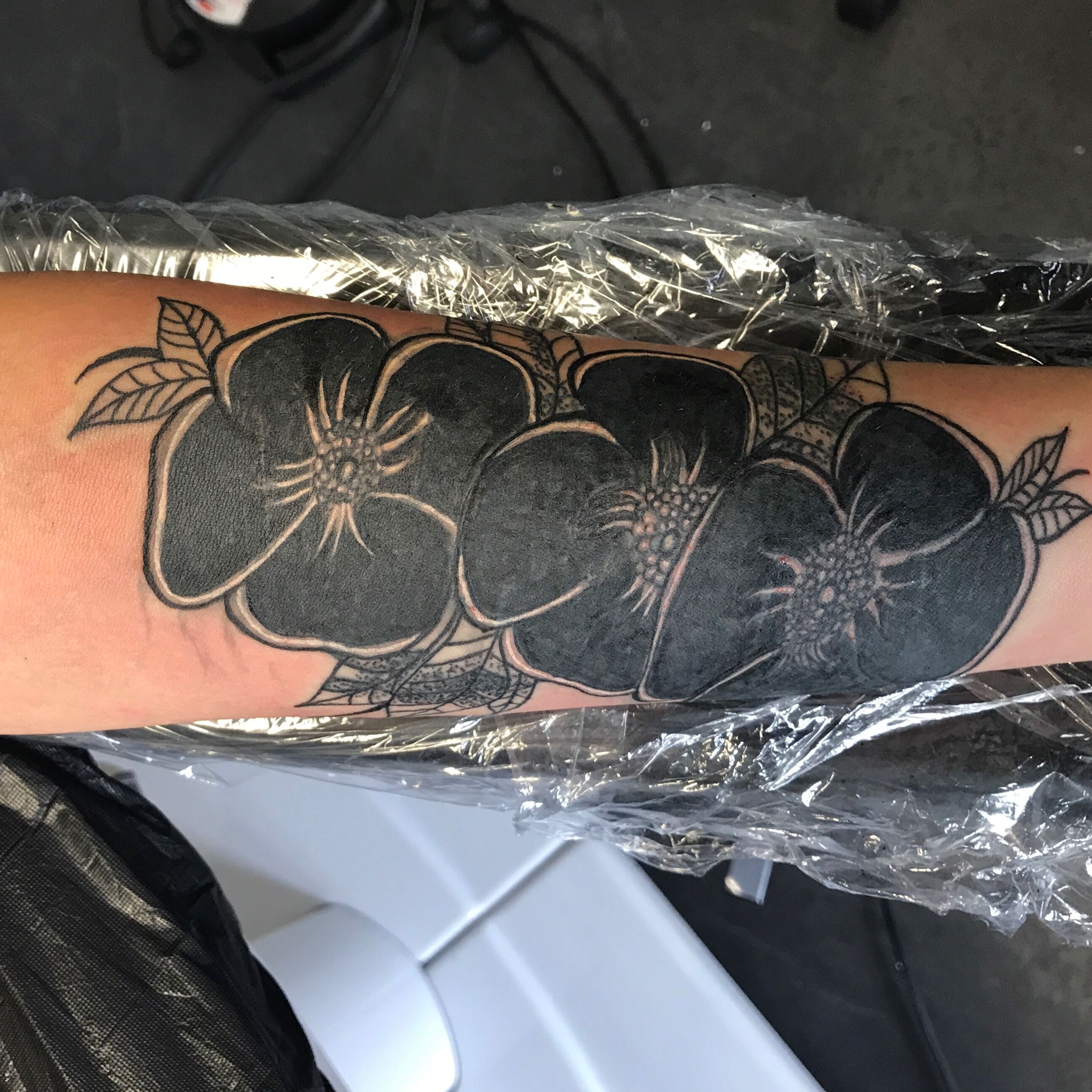 Tattoo entferen lassen? (Laser, tattooentfernung, Cover Up)