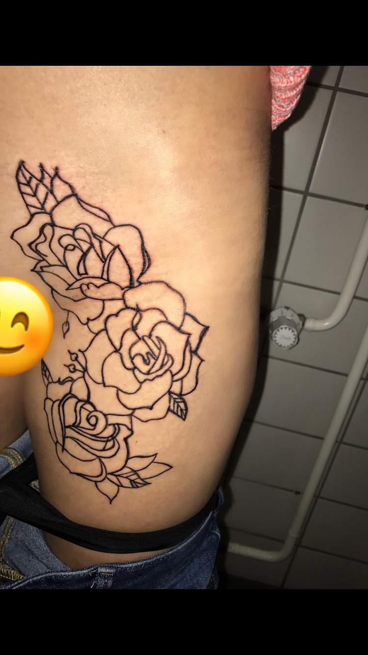 Tattoo Entfernen Berlin/ Kosten? (Geld, Arzt, Schmerzen)