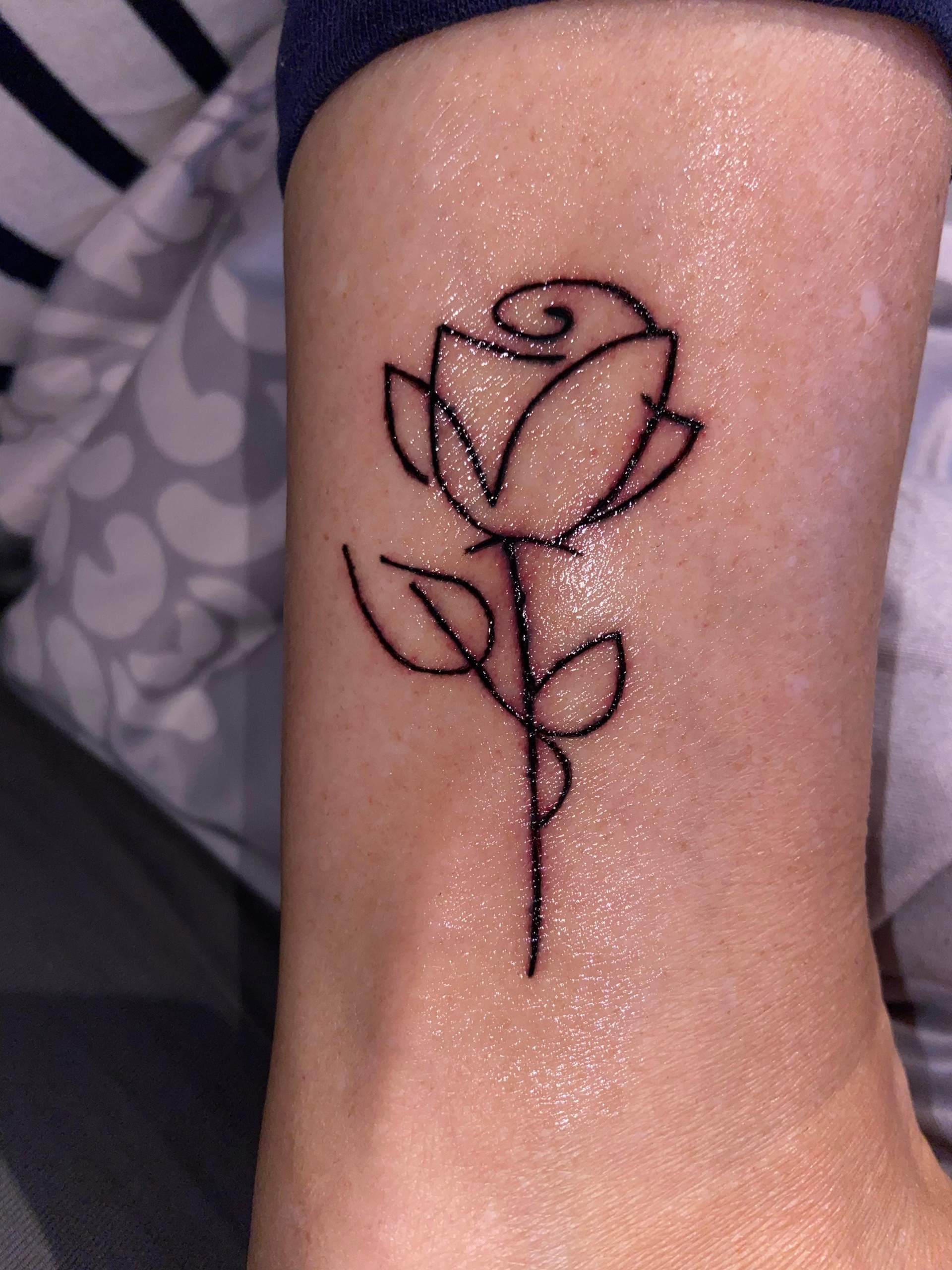 Tattoo entzündet? (Gesundheit und Medizin)