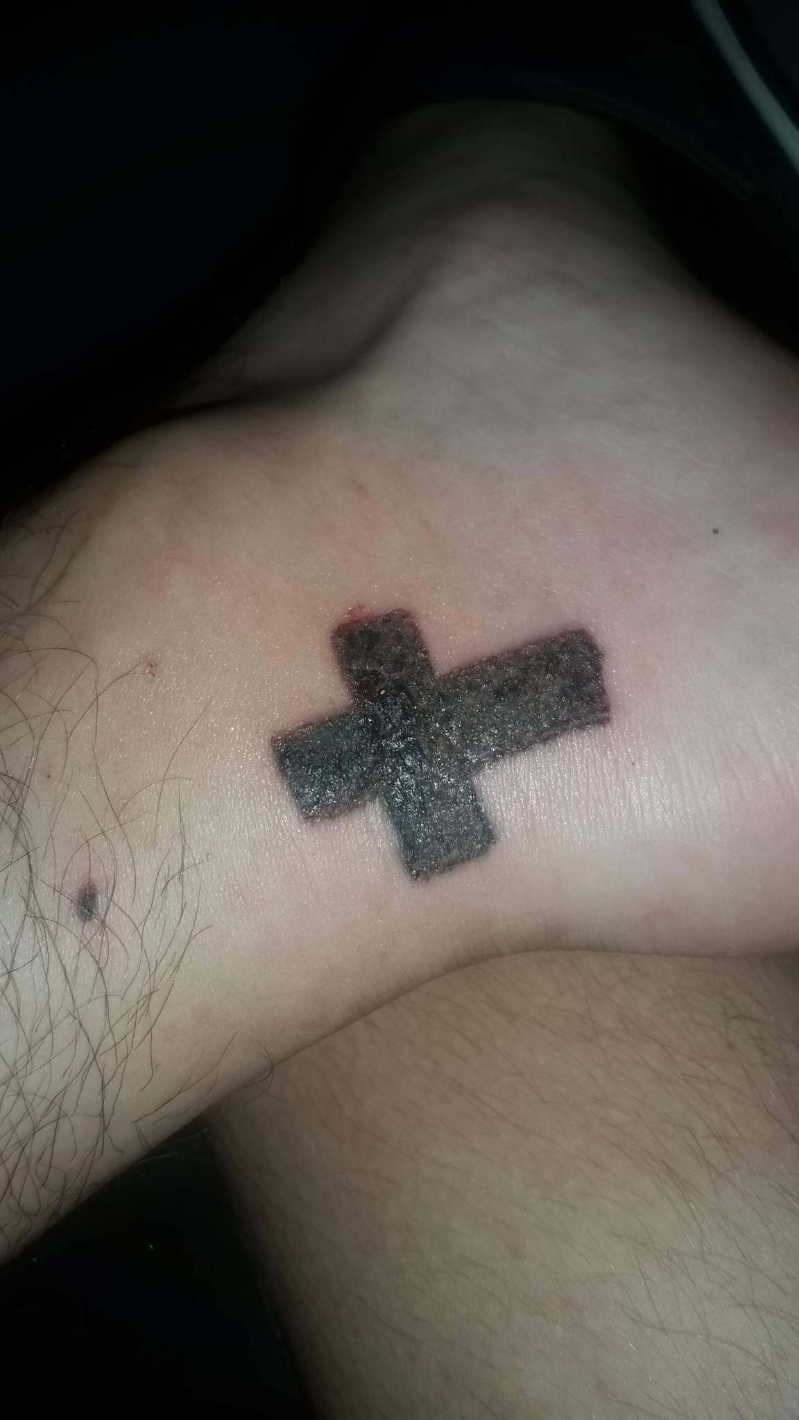Tattoo entzündet oder normal? (Entzündung)
