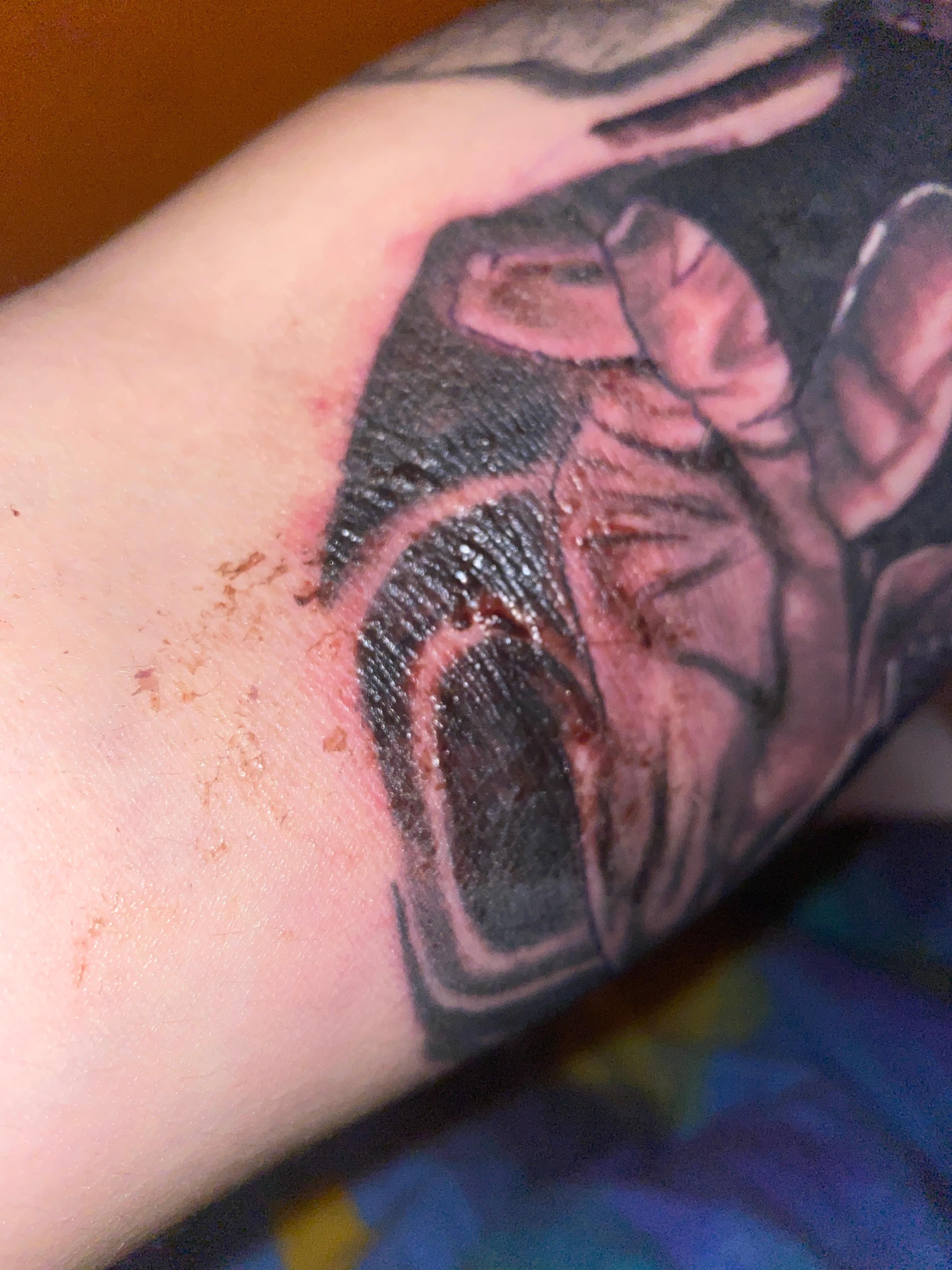 Tattoo entzündet oder normall? (Tattoostudio, Tattoopflege)