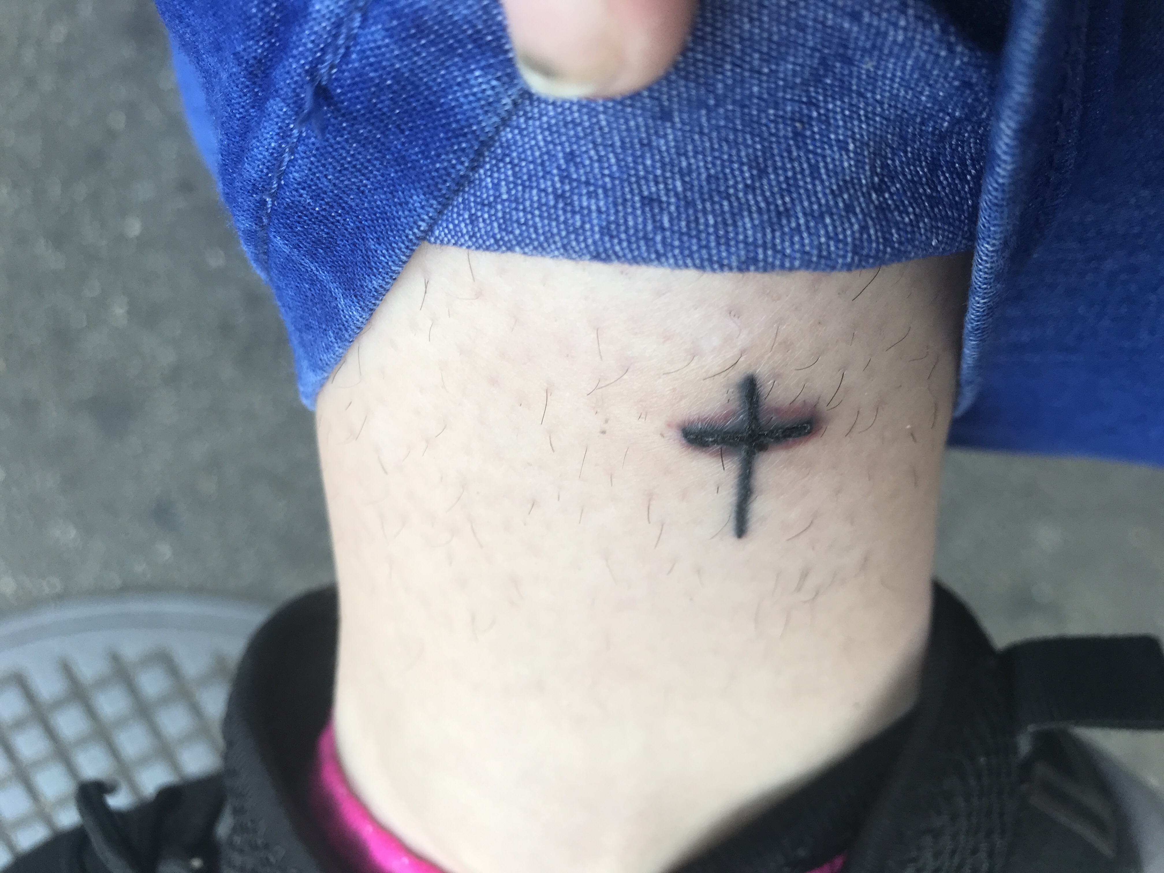 Tattoo entzündet was jetzt? (Gesundheit und Medizin, Entzündung)