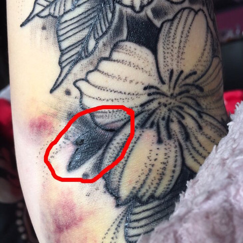 Diese roten Flecken an der Seite sind nur Blutergüsse nix schlimmes  - (Gesundheit, Körper, Tattoo)