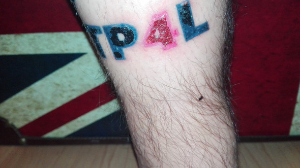 Tattoo Hat Eine Dicke Kruste Sieht Das Bedenklich Aus Pflege Tattoo Hat Eine Dicke Kruste Sieht Das Bedenklich Aus Pflege