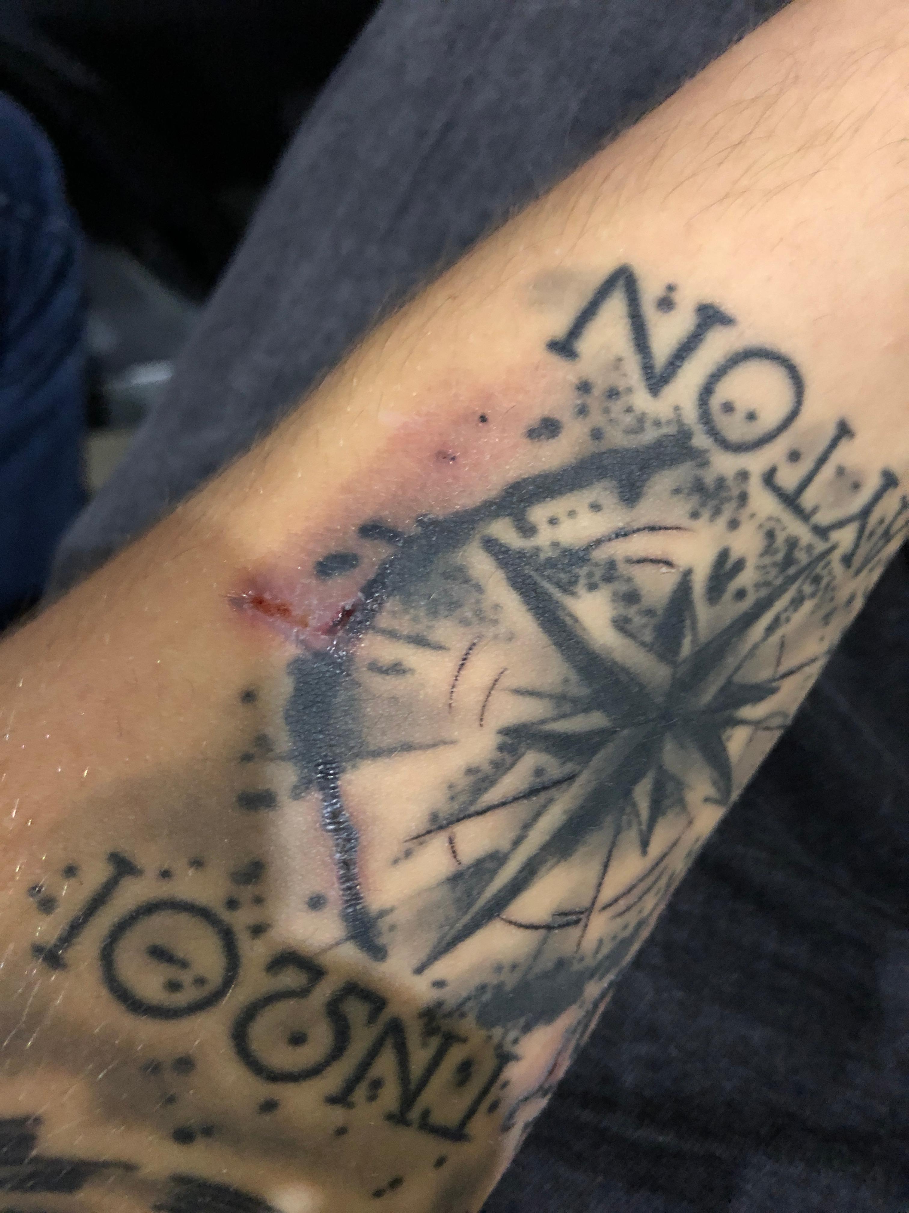 Tattoo heilt nicht richtig ab? (Tattoopflege)
