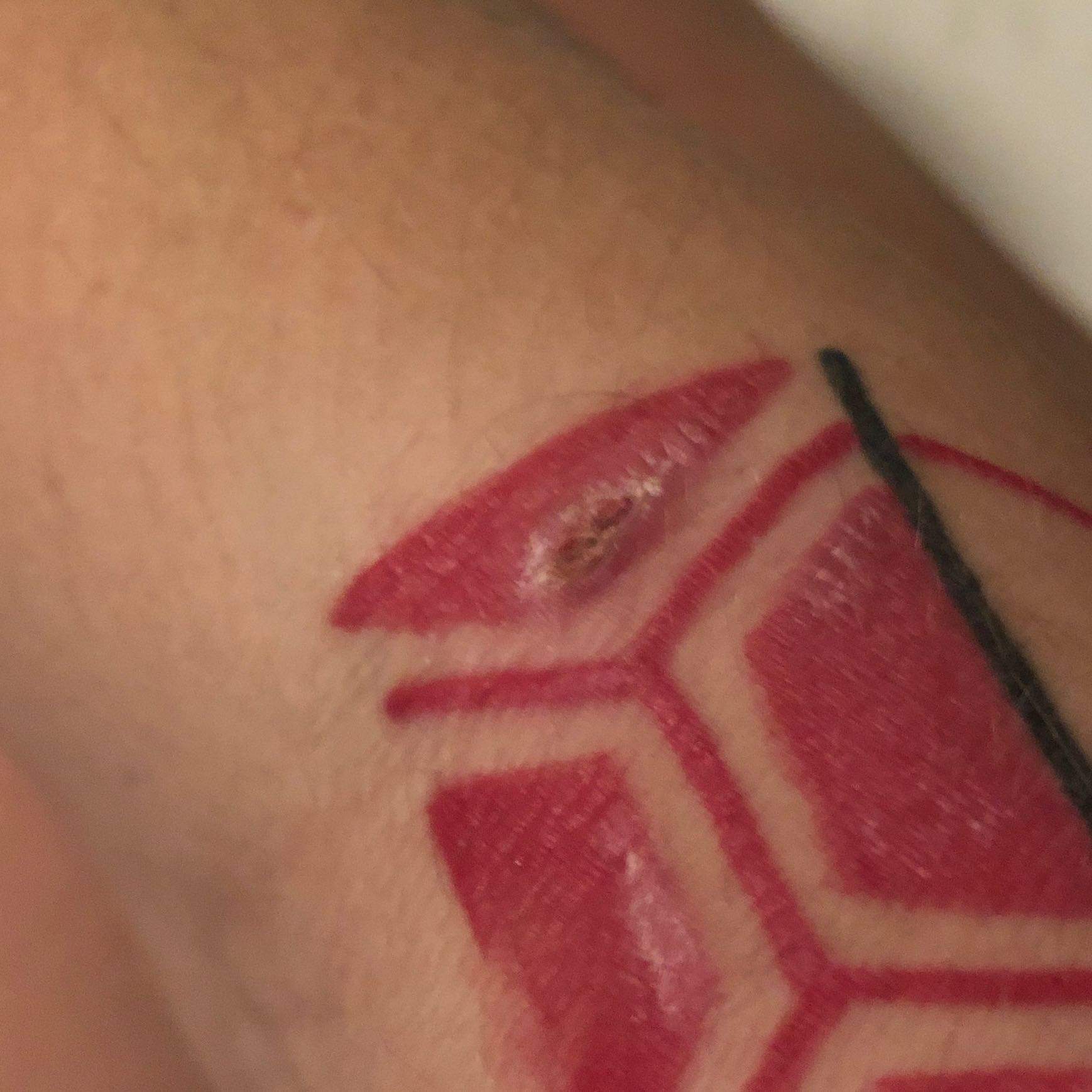 Tattoo Heilung was kann ich tun? (Gesundheit und Medizin, stelle, Kruste)