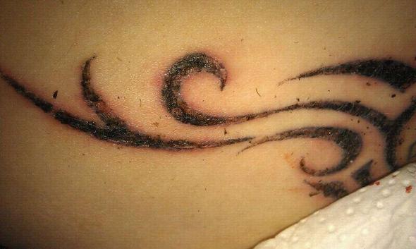 Tattoo Im Studio Nun Entzundet Anwalt Entzundung Hautarzt