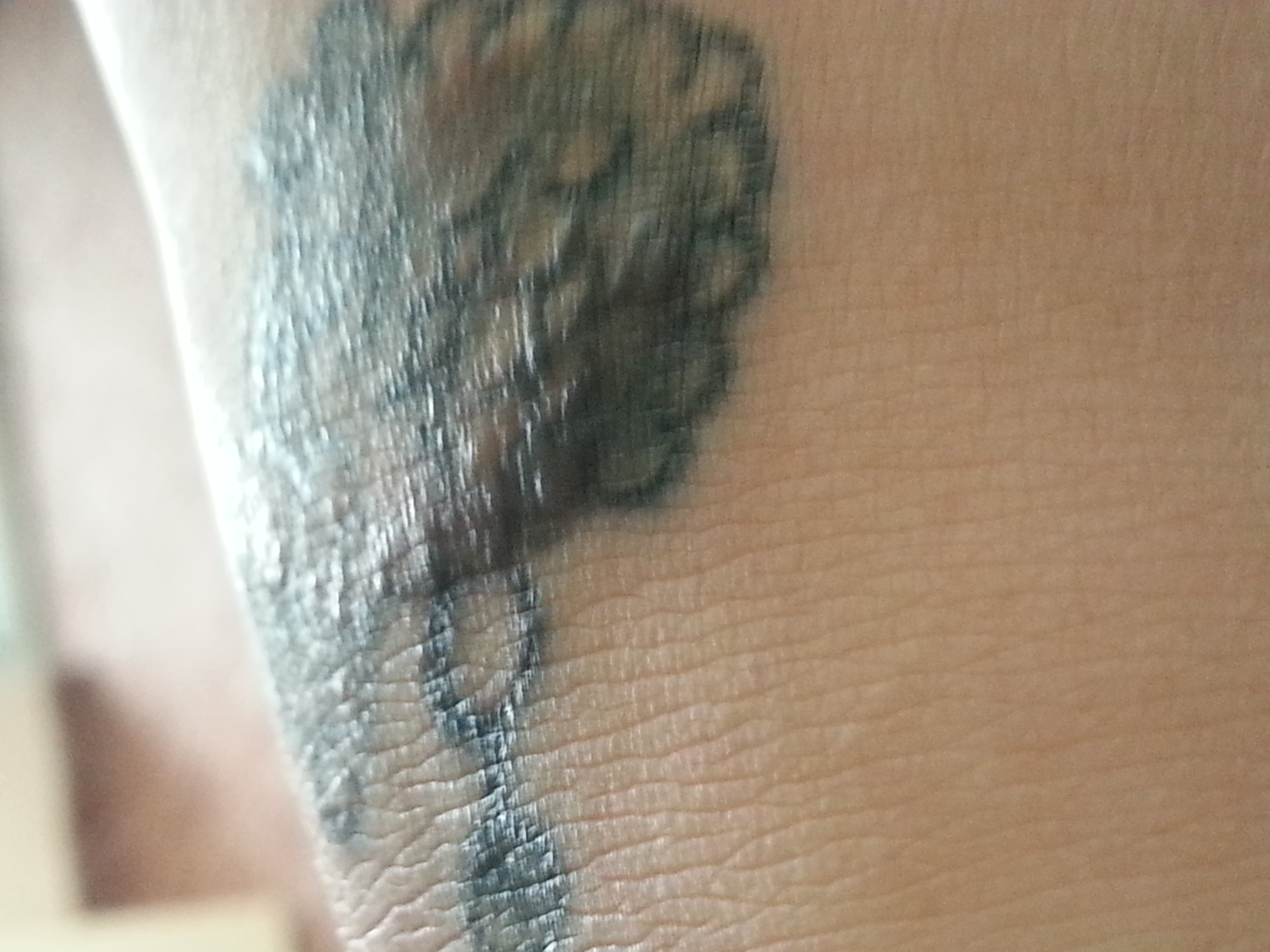 Tattoo juckt &amp; hat pocken! (Gesundheit, Haut)