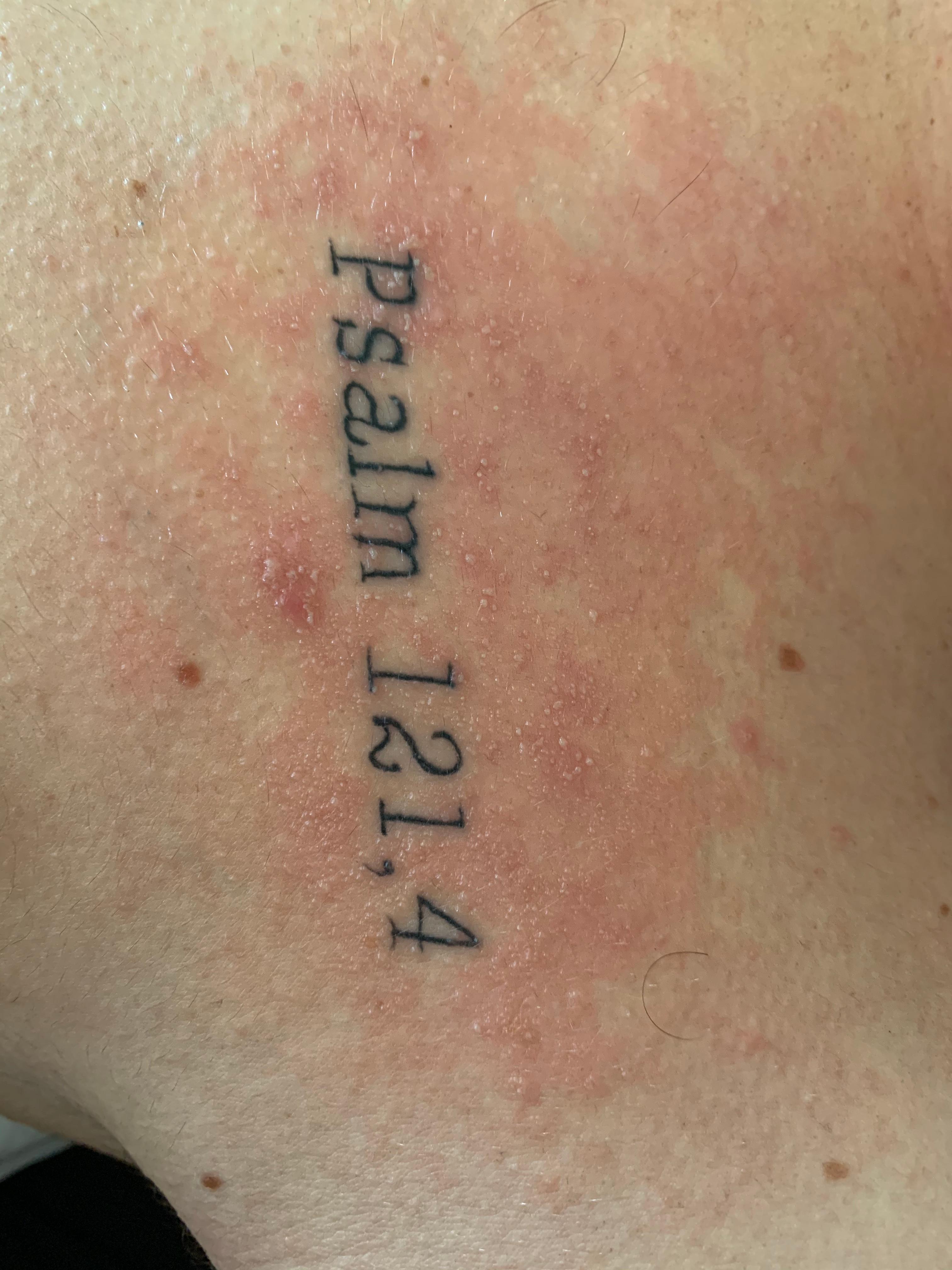 Tattoo juckt nach 2 Wochen und über Nacht &quot;Bläschen&quot;? (Gesundheit und
