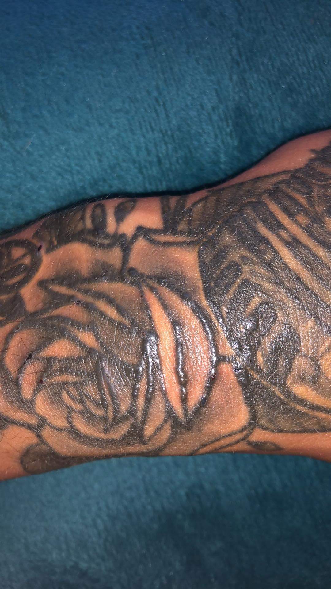 Tattoo Linien Geschwollen Und Juckt Gesundheit Und Medizin Haut Tattoopflege Tattoo Linien Geschwollen Und Juckt Gesundheit Und Medizin Haut Tattoopflege