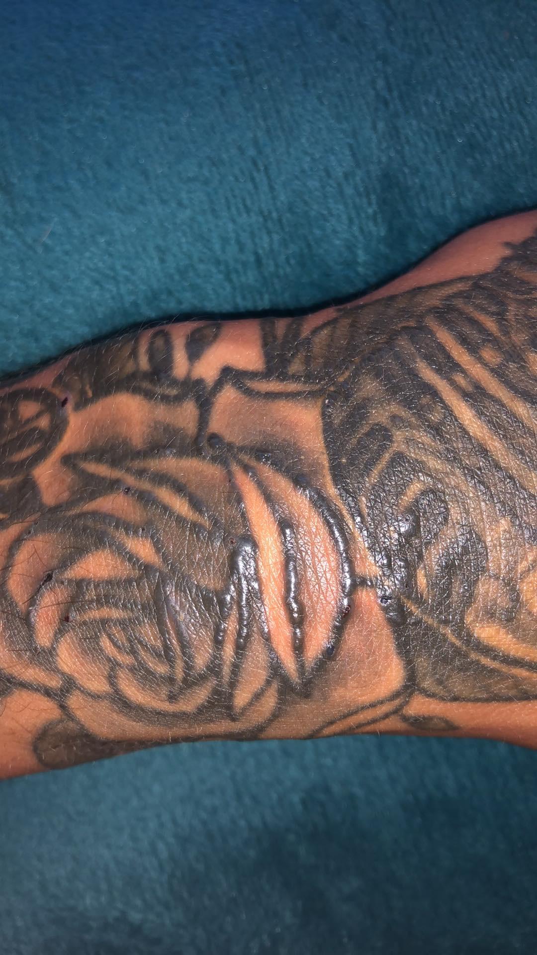 tattoo schwillt an