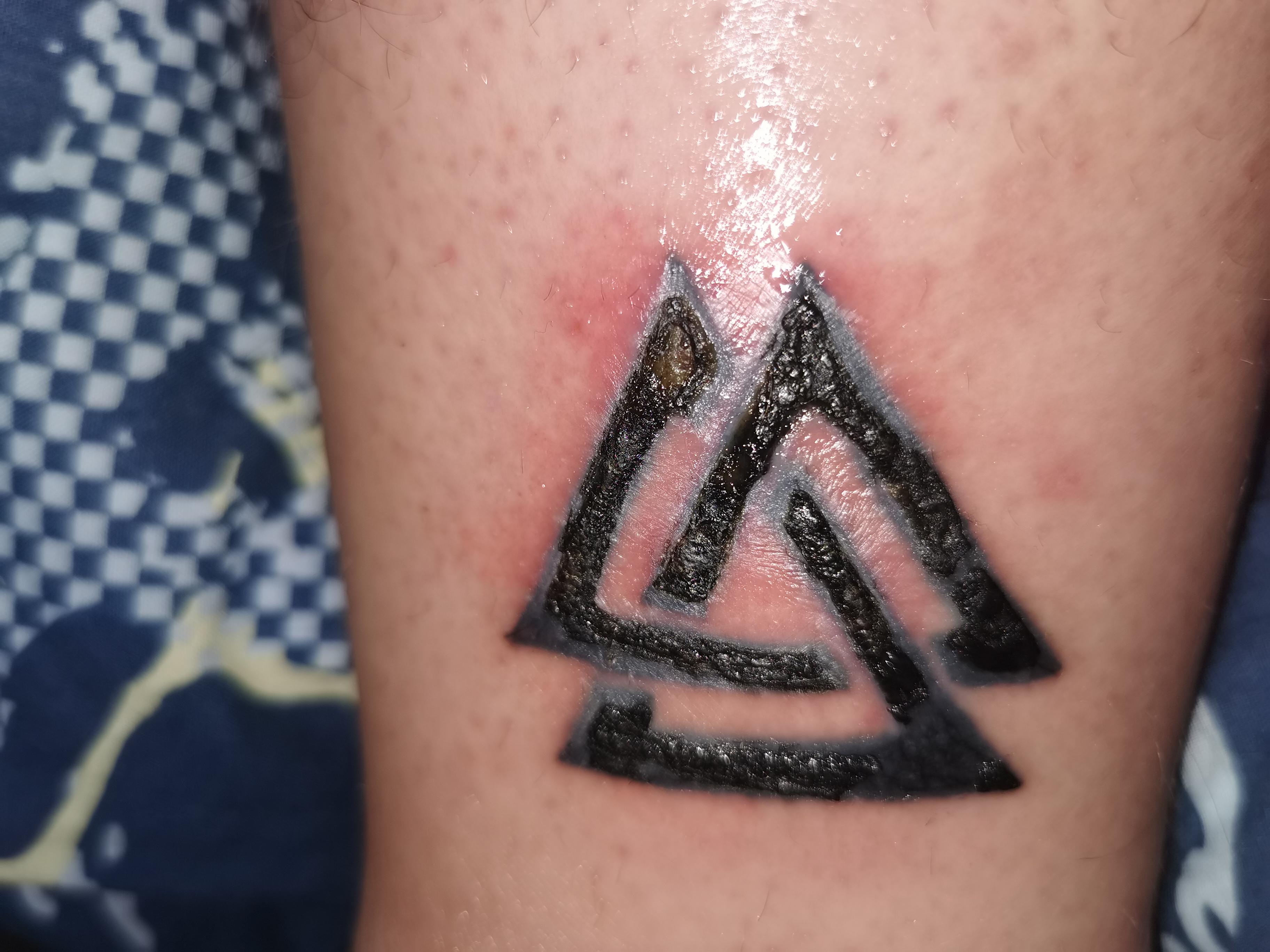 Tattoo nach 2 Wochen Alles im grünen Bereich? (Gesundheit und Medizin