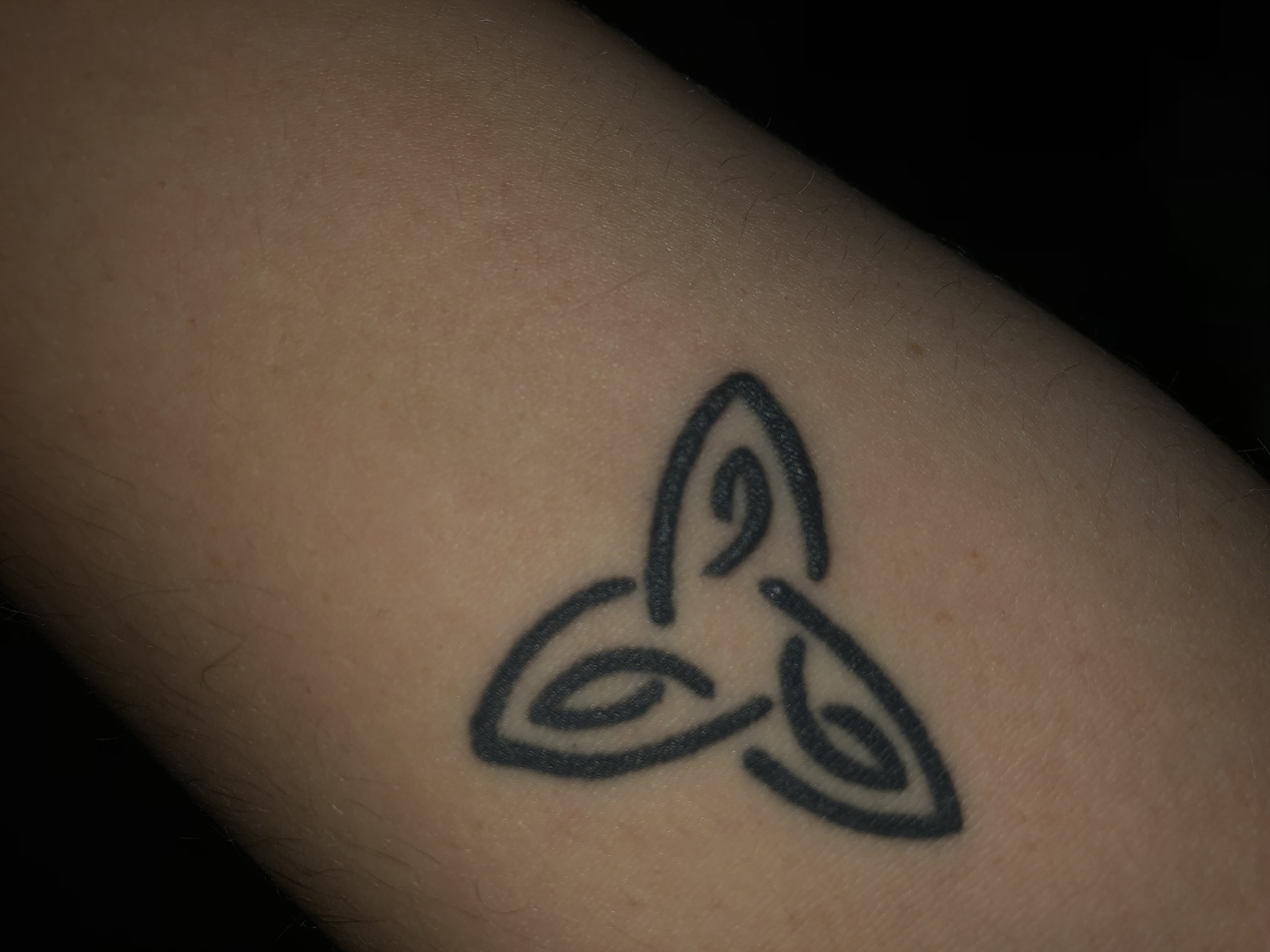 Tattoo nach 8monaten angeschwollen? (Arzt, Hautarzt)