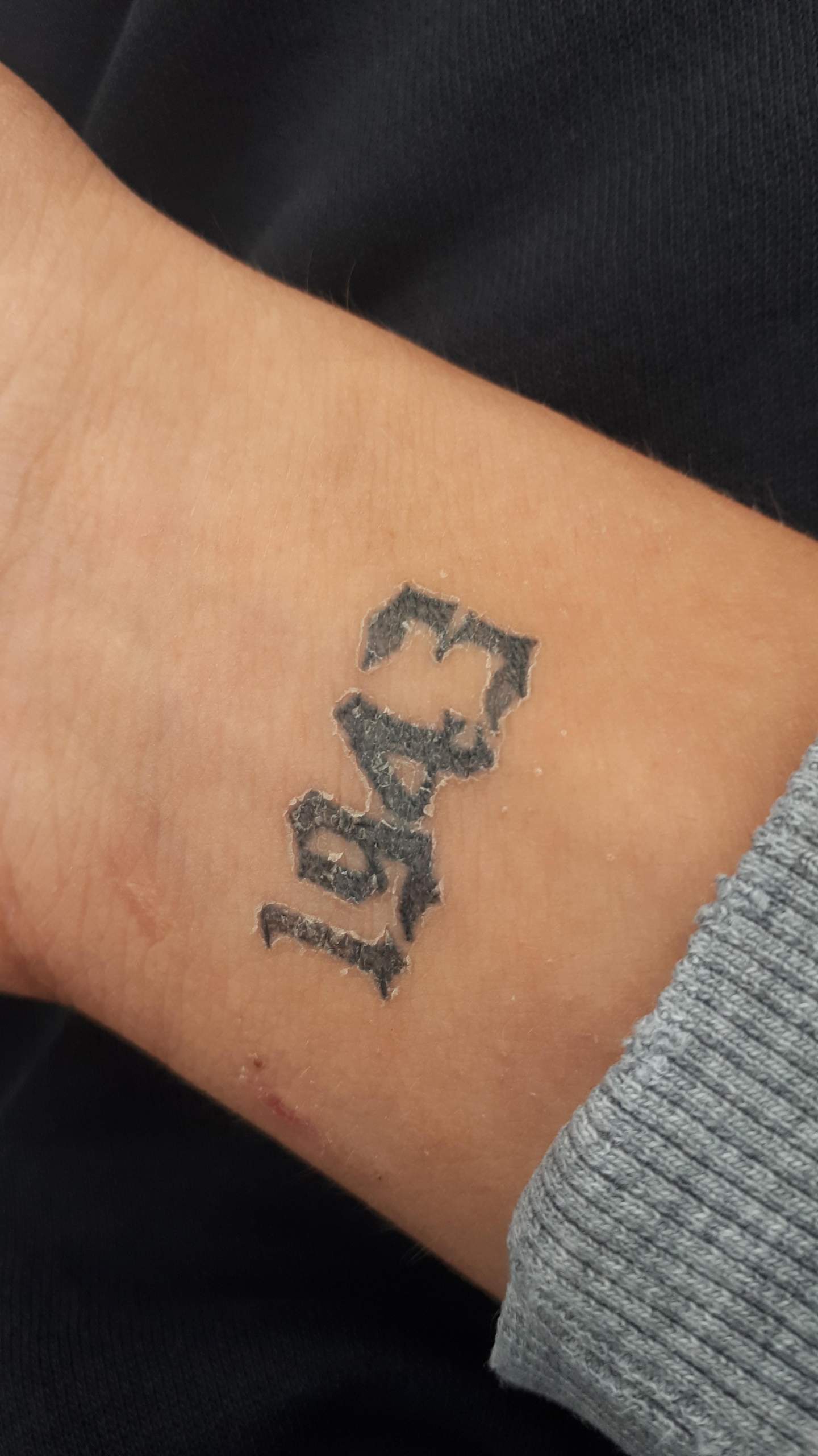 Tattoo nach dem duschen krustig und pellt ab? (Tattoopflege)