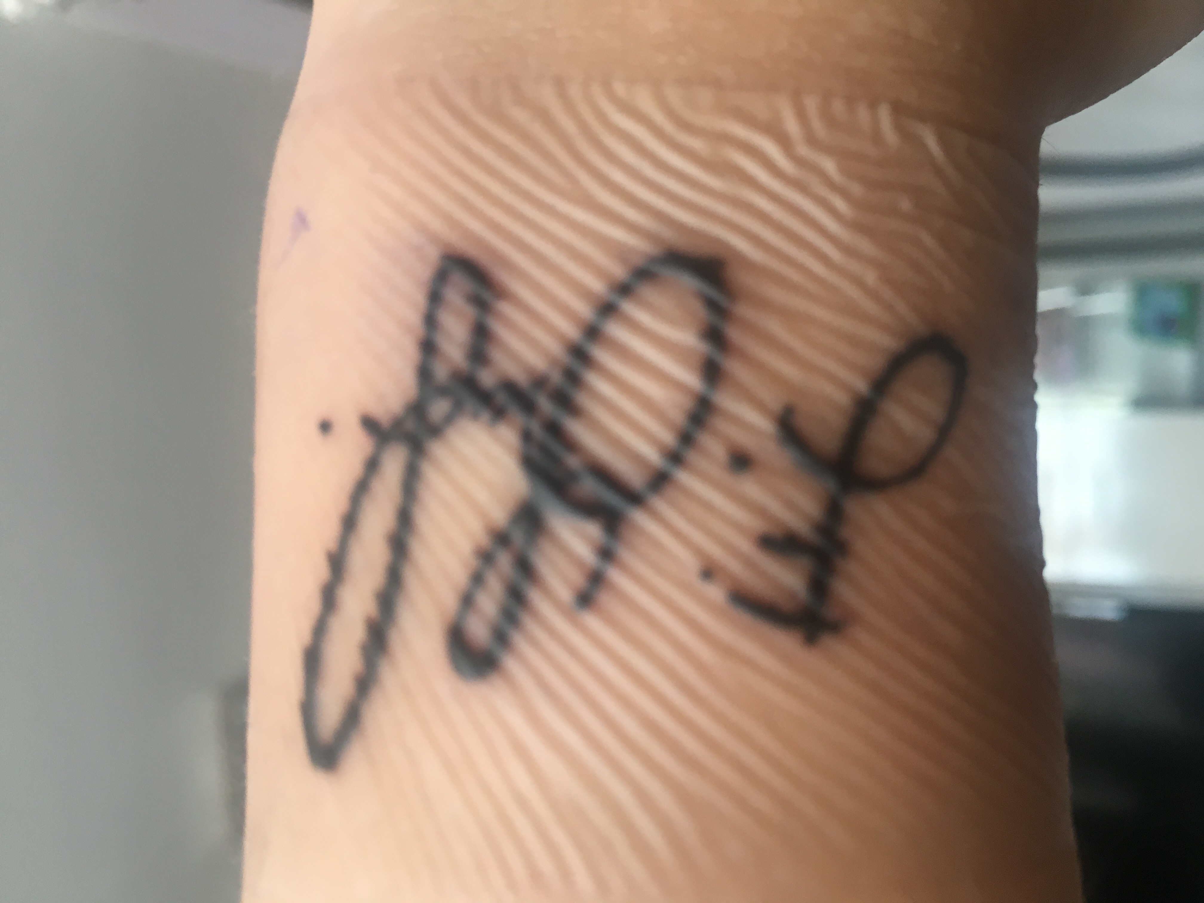 Tattoo normal oder nicht normal? (unsicher)