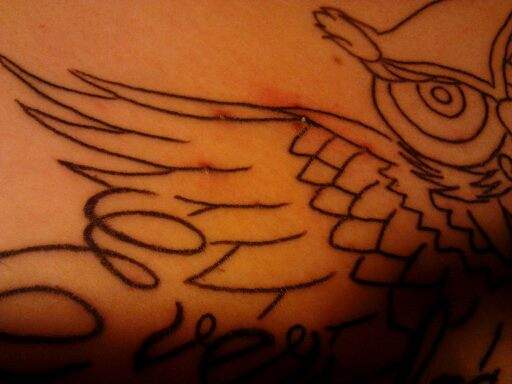 Tattoo Pickelchen. Hilfe!