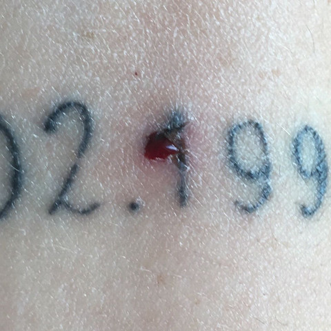 Blutendes Loch im Tattoo - (Gesundheit und Medizin, Gesundheit, Recht)