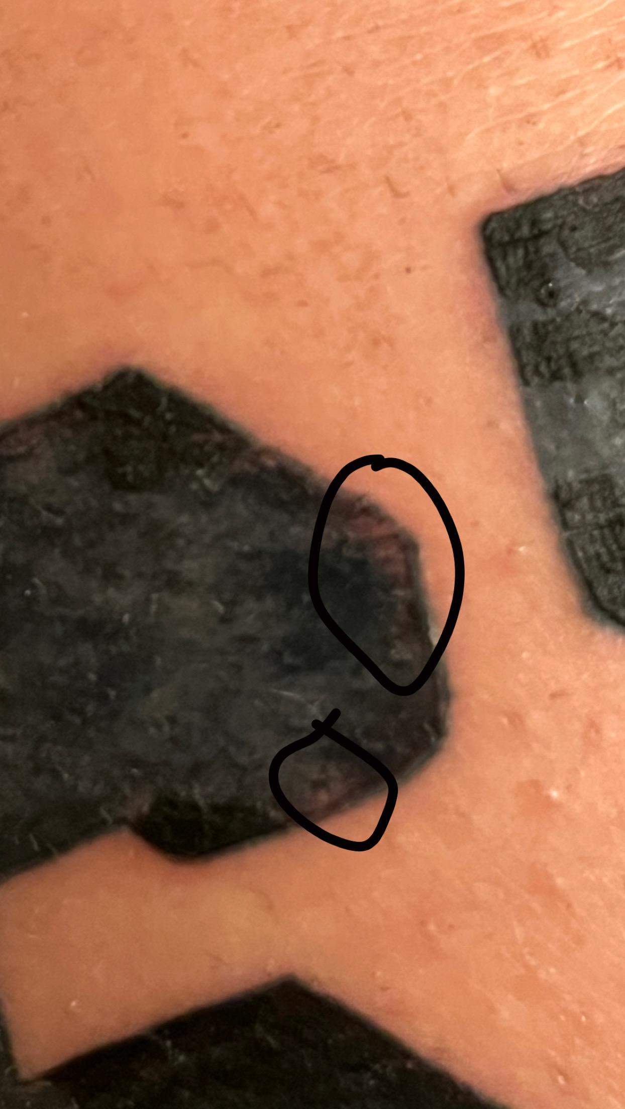 Tattoo schlecht gestochen? (Tätowierer)