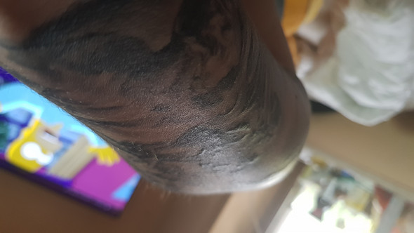 Tattoo schwillt an u d wird rot nach 6 monaten? (Gesundheit, Medizin, Arzt) Tattoo schwillt an u d wird rot nach 6 monaten? (Gesundheit, Medizin, Arzt)