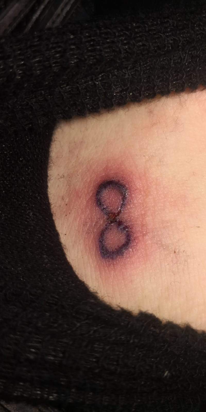 Tattoo Selbst Gestochen Blutvergiftung Tattoopflege Stick N Poke