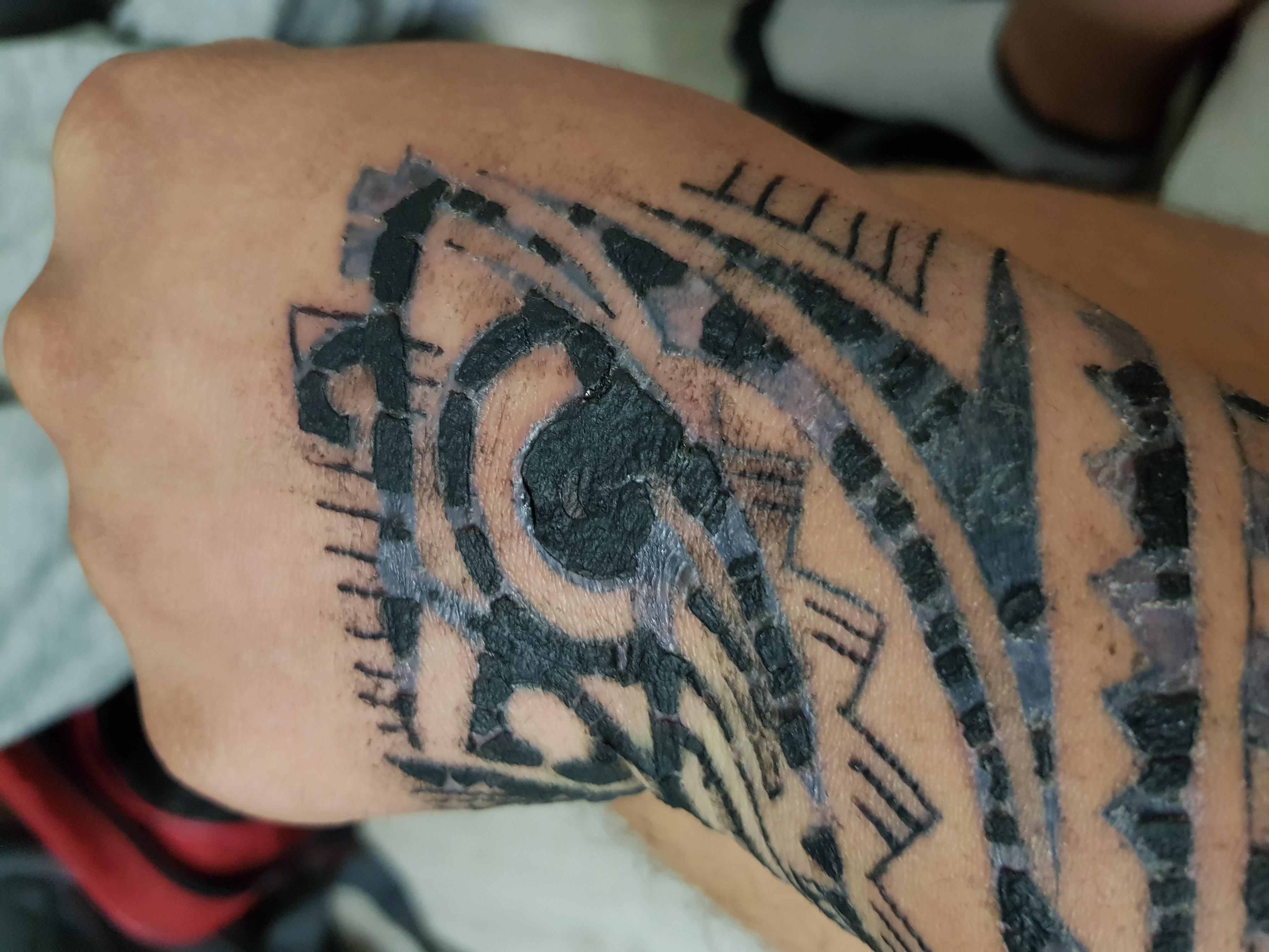 Tattoo unprofessionell? (Farbe, Kruste, Wundenheilung)