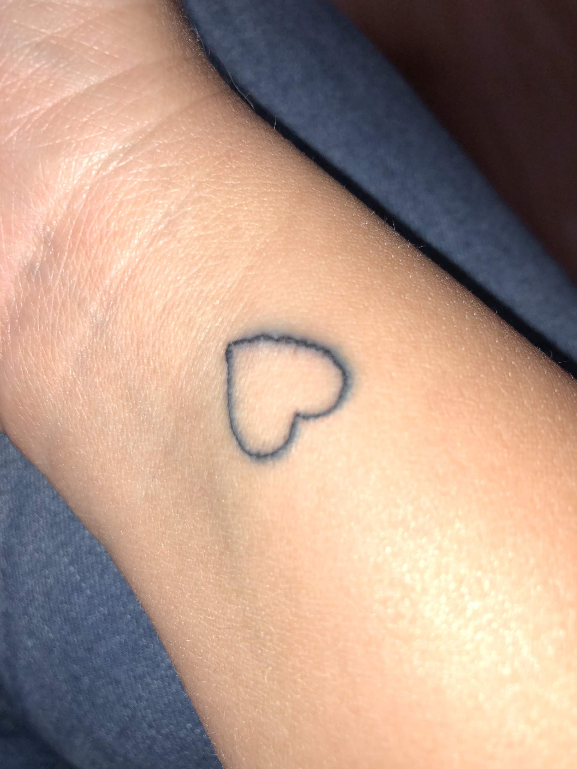 Tattoo Verlaufen und zu dicke Kruste?