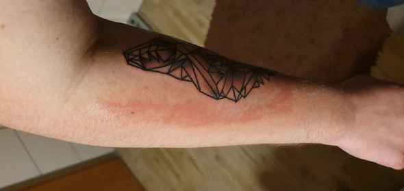 Tattoo Was Ist Das Rote Rote Flecken