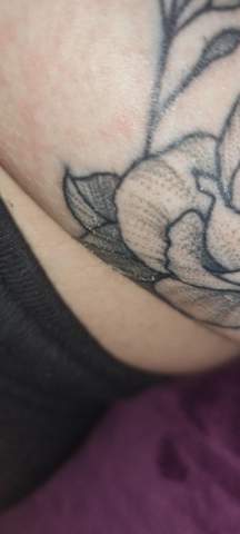 Tattoo weißer Schorf, Kleber Allergie?