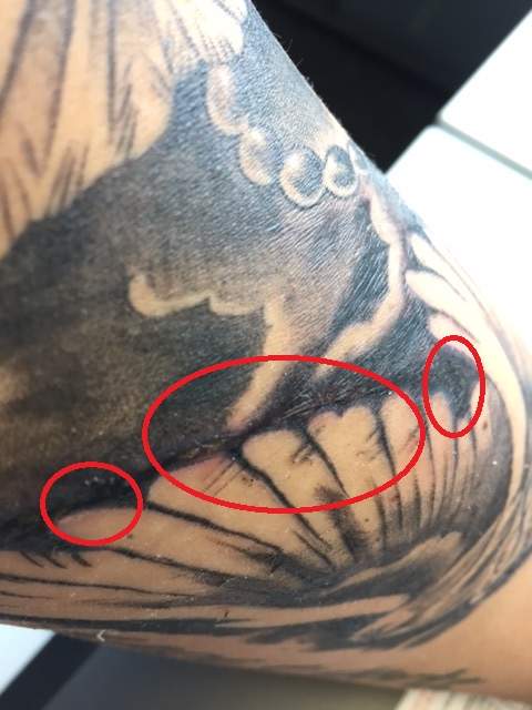 Tattooheilung Was Ist Hier Passiert Oder Ist Das Normal Tattoo Tattooheilung Was Ist Hier Passiert Oder Ist Das Normal Tattoo