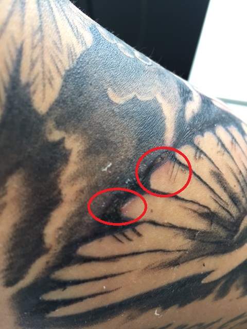 Tattooheilung Was Ist Hier Passiert Oder Ist Das Normal Tattoo 