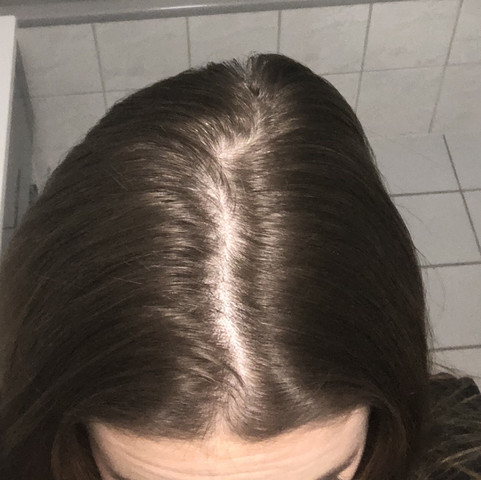 Thema Haarausfall Ja Oder Nein Gesundheit Haare Beauty