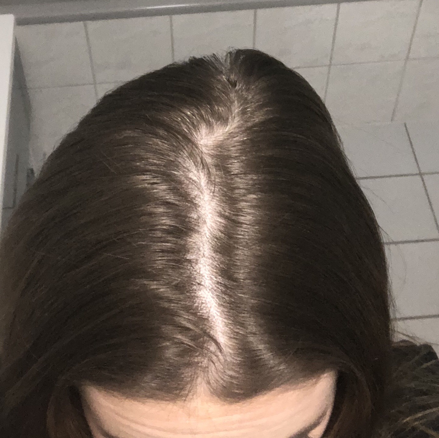 thema haarausfall ja oder nein