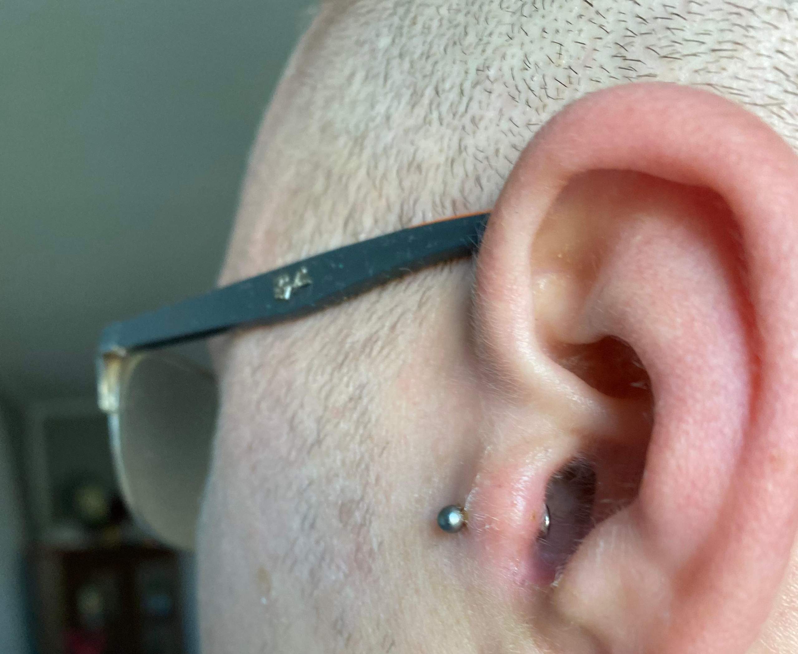 Tragus entzündet nach 4 Tagen? (Piercing, Entzündung, knorpelpiercing)