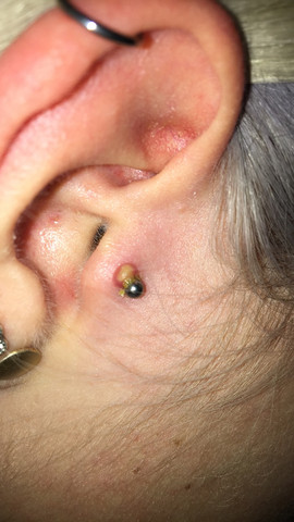 tragus piercing entzundet was tun