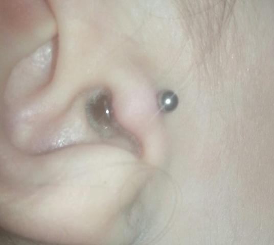 tragus piercing angeschwollen zu kurzer stab hilfe schwellung piercer