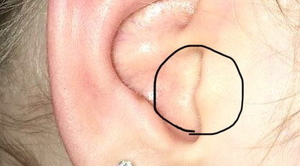 Tragus Piercing Bei Kleinem Knorpel Beauty Ohrringe Piercing Stechen