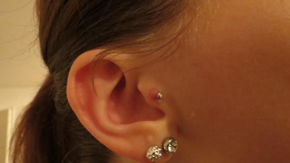 tragus piercing richtig schlimm entzundet