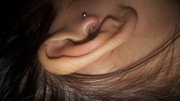 Tragus Piercing Stark Geschwollen Gesundheit Und Medizin Schmerzen Piercer