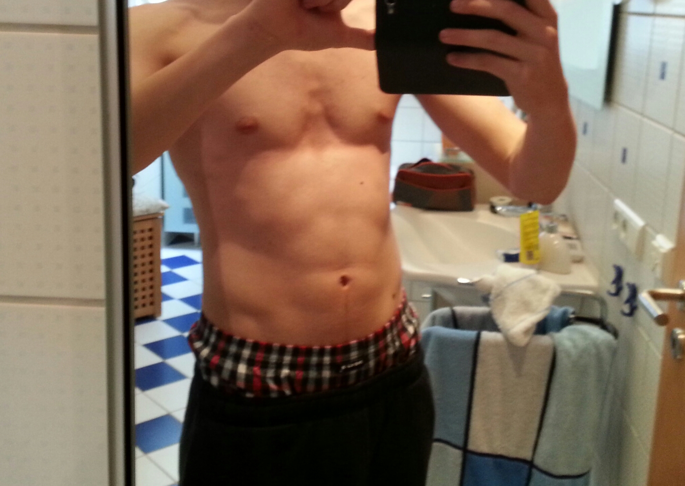 Trichterbrust mit Saugglocke? (Gesundheit, Körper)