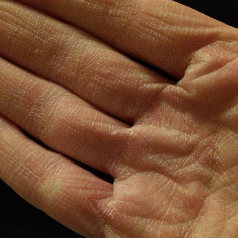 Trockene Hände nach Benutzung einer Antihydral Handcreme! (Pflege, Hand, Creme)